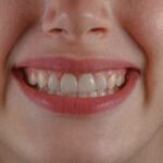 How Much to Fix a Chipped Tooth? Proven Treatment Options, Costs & Results