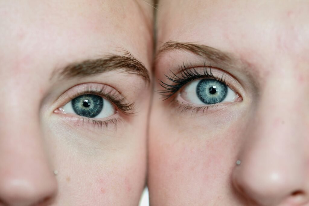 Will Hardened Chalazion Go Away? Ultimate Guide to Healing & When to Get Help guide to hardened chalazion care, healing, persistent symptoms, treatment, and eye health.