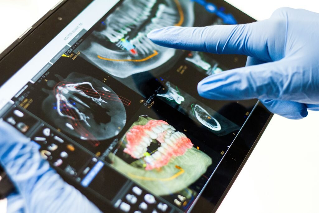 Why Are Dental Implants So Expensive? Real Cost Breakdown guide to implant surgery, restoration costs, dental materials, additional procedures, and treatment expenses.