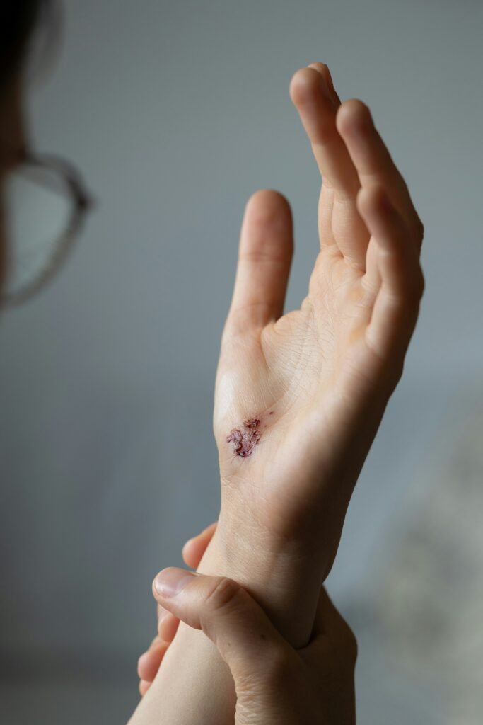 Why Do Healing Wounds Itch? Causes, Relief, and Warning Signs guide to wound healing, itching causes, skin repair, wound care, and warning symptoms.