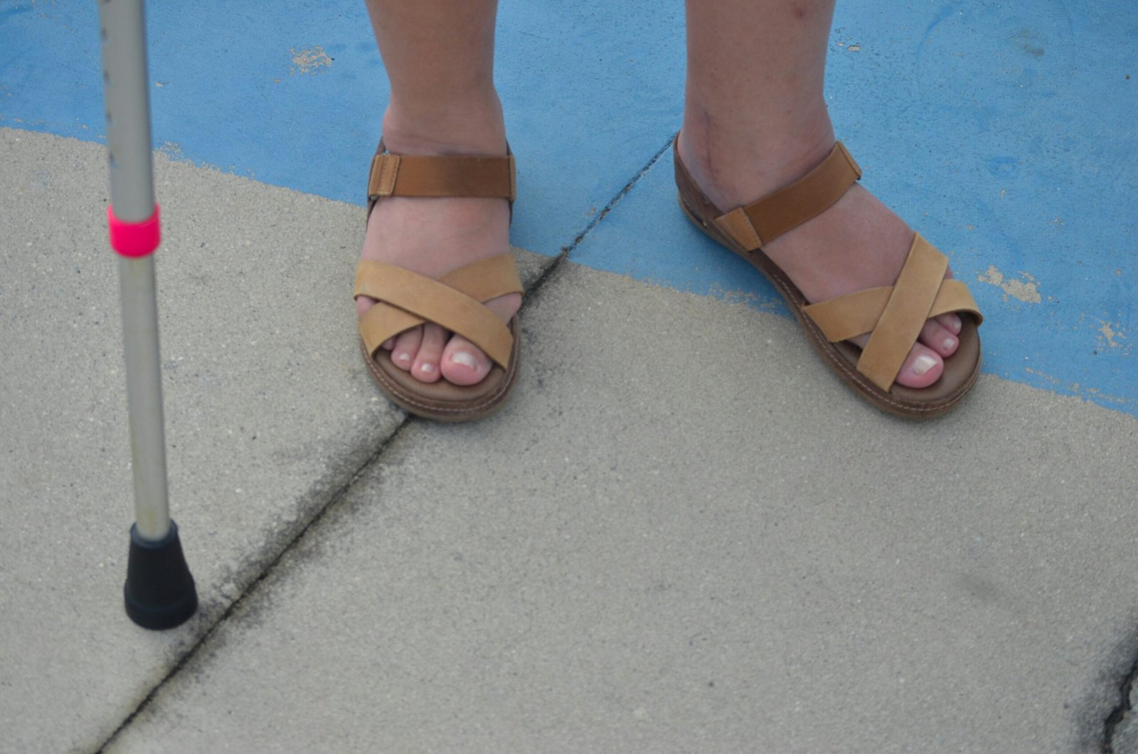 Duct Tape Pulled Out Plantar Wart Root? Shocking Details, Causes & Safe Next Steps